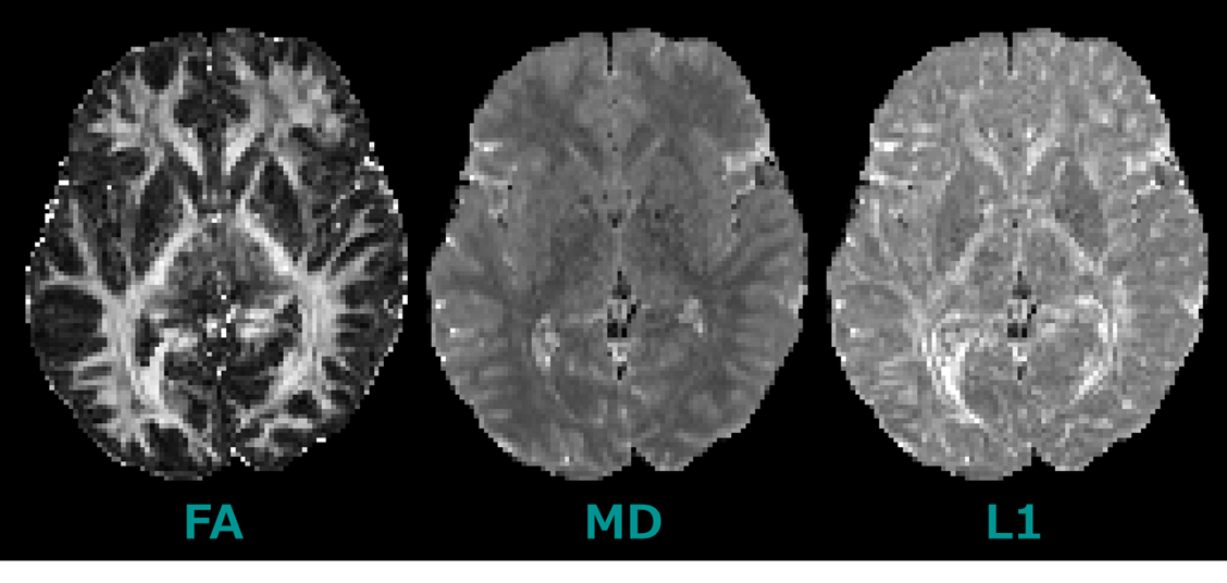 FSL】FSLを用いた拡散テンソルイメージング: DTI | K-Lab